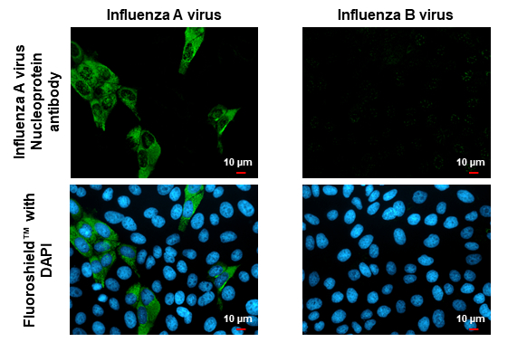 Anti-Influenza A virus Nucleoprotein antibody (GTX125989